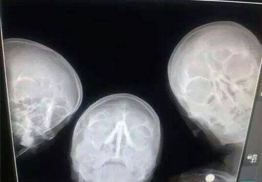 Radiologists Selfie